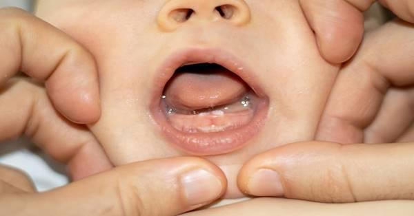 Chó con đang gặm đồ chơi nhai trong giai đoạn thay răng, với nướu có dấu hiệu sưng nhẹ, thể hiện sự khó chịu