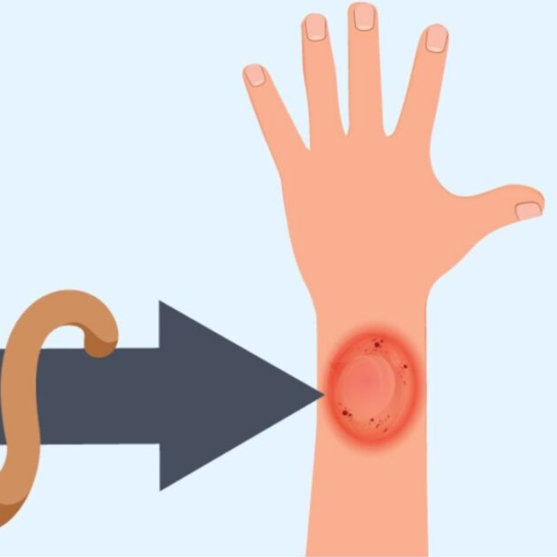 Một người đang làm vệ sinh tay bằng xà phòng để ngăn ngừa nấm mèo lây lan.