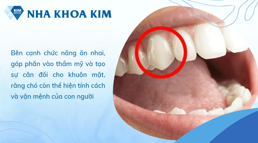 Người sở hữu răng chó thể hiện cá tính mạnh mẽ và quyết đoán