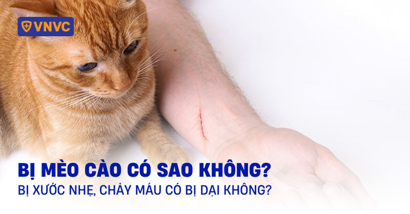Hình ảnh vết mèo cào trên da người cần được vệ sinh và theo dõi cẩn thận