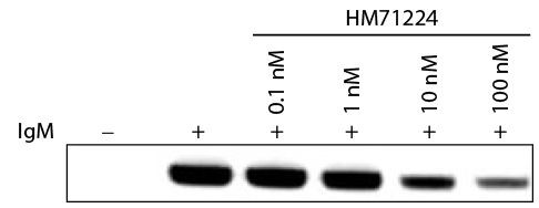 Sơ đồ điện di protein từ tế bào Ramos, minh họa phản ứng kháng thể với IgM người